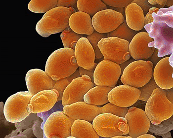 Image: Colored scanning electron micrograph (SEM) of Candida albicans yeast cells (Photo courtesy of Steve Gschmeissner / SPL).